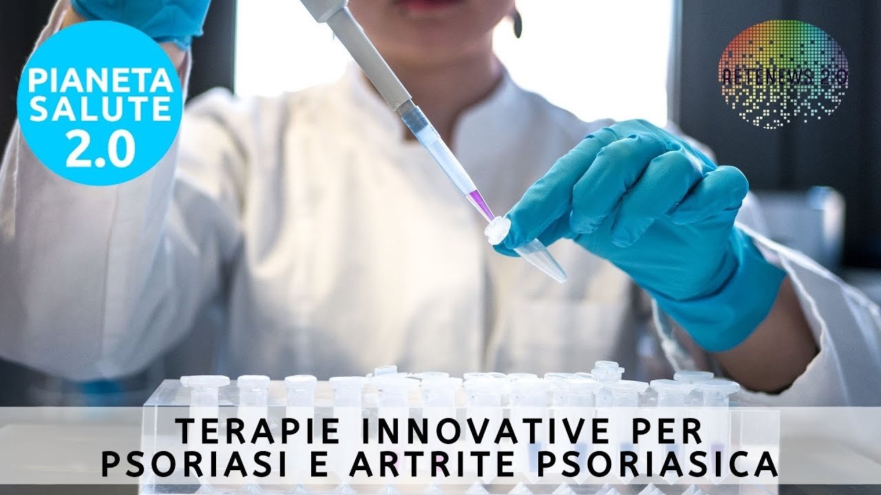 Nuovi trattamenti di psoriasi e artrite psoriasica: guselkumab