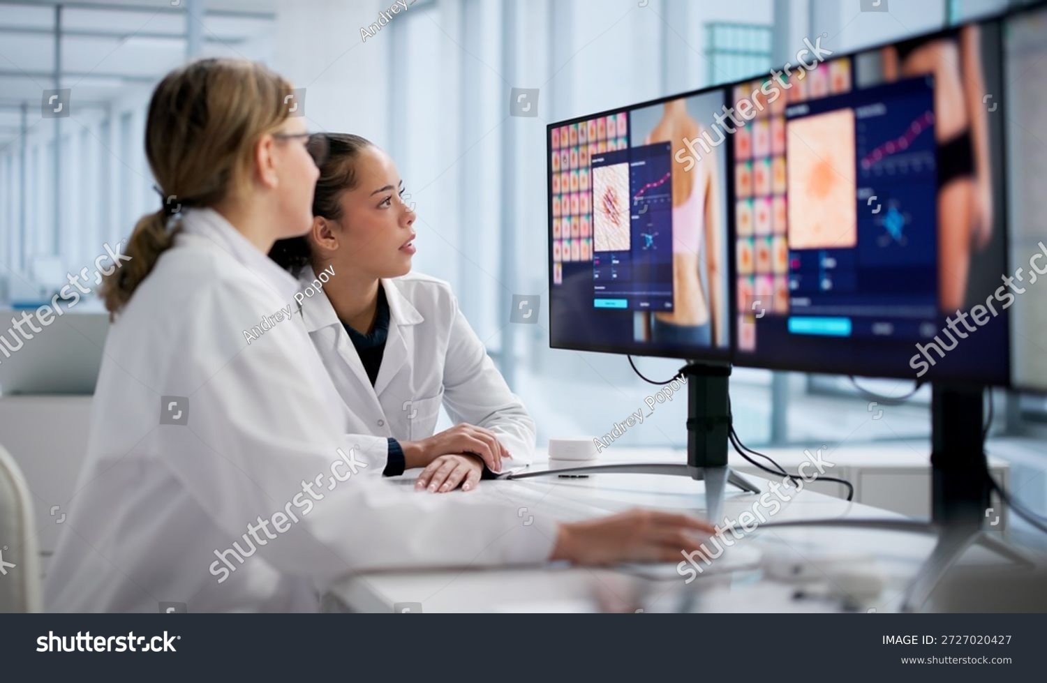 Immagine illustrativa, Melanoma